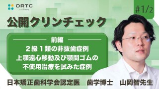 2級1類の非抜歯症例 上顎遠心移動及び顎間ゴムの不使用治療を試みた症例　前編【インビザライン】