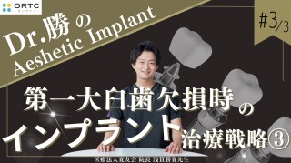 【インプラント】第一大臼歯欠損時のインプラント治療戦略3