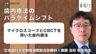 マイクロスコープとCBCTを用いた歯内療法【歯内療法】