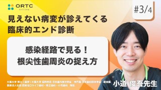 感染経路で見る!根尖性歯周炎の捉え方