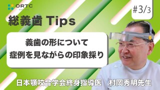 義歯の形について_症例を見ながらのコピーデンチャーの改造【総義歯】