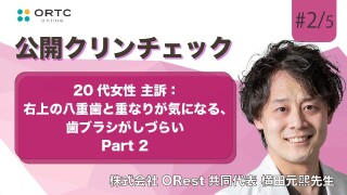 20代女性、主訴:右上の八重歯と重なりが気になる、歯ブラシがしづらい パート2