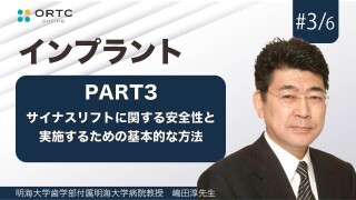 サイナスリストに関する安全性と実施するための基本的な方法　PART3