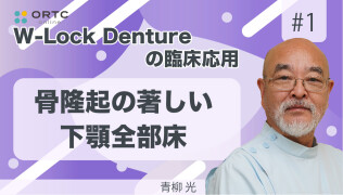 W-Lock Dentureの臨床応用 骨隆起の著しい下顎全部床