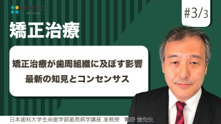 矯正治療が歯周組織に及ぼす影響  最新の知見とコンセンサス