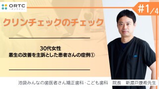 【インビザラインクリンチェック/矯正症例】30代女性 叢生の改善を主訴とした患者さんの症例1