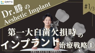 【インプラント】第一大臼歯欠損時のインプラント治療戦略1