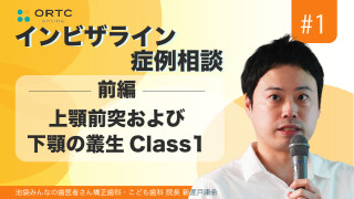 上顎前突および下顎の叢生Class1　前編