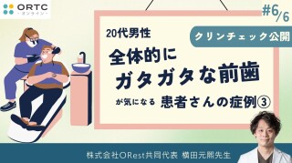 20代男性,全体的にガタガタな前歯が気になる3