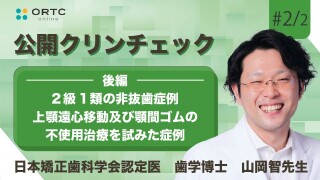 2級1類の非抜歯症例 上顎遠心移動及び顎間ゴムの不使用治療を試みた症例　後編【インビザライン】