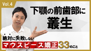 下顎の前歯部に叢生がある場合 絶対に失敗しないマウスピース矯正33のこと
