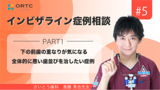 斎藤先生が 実際にクリンチェックを操作しながら解説、症例相談